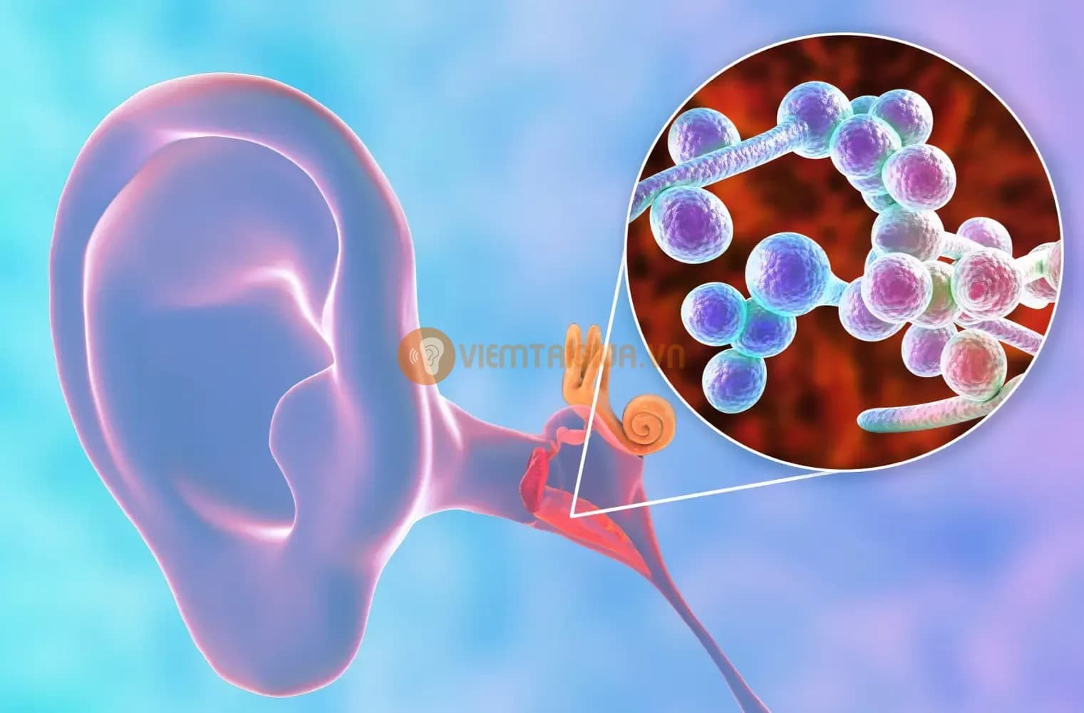Những biến chứng viêm tai giữa ở trẻ em cha mẹ nên biết