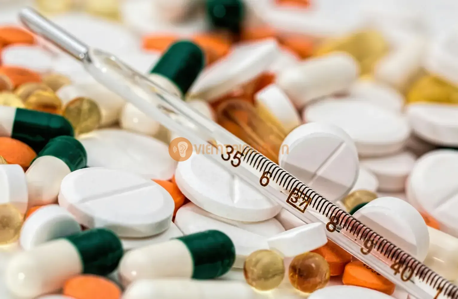 Viêm tai giữa để lại biến chứng nặng nề ở trẻ