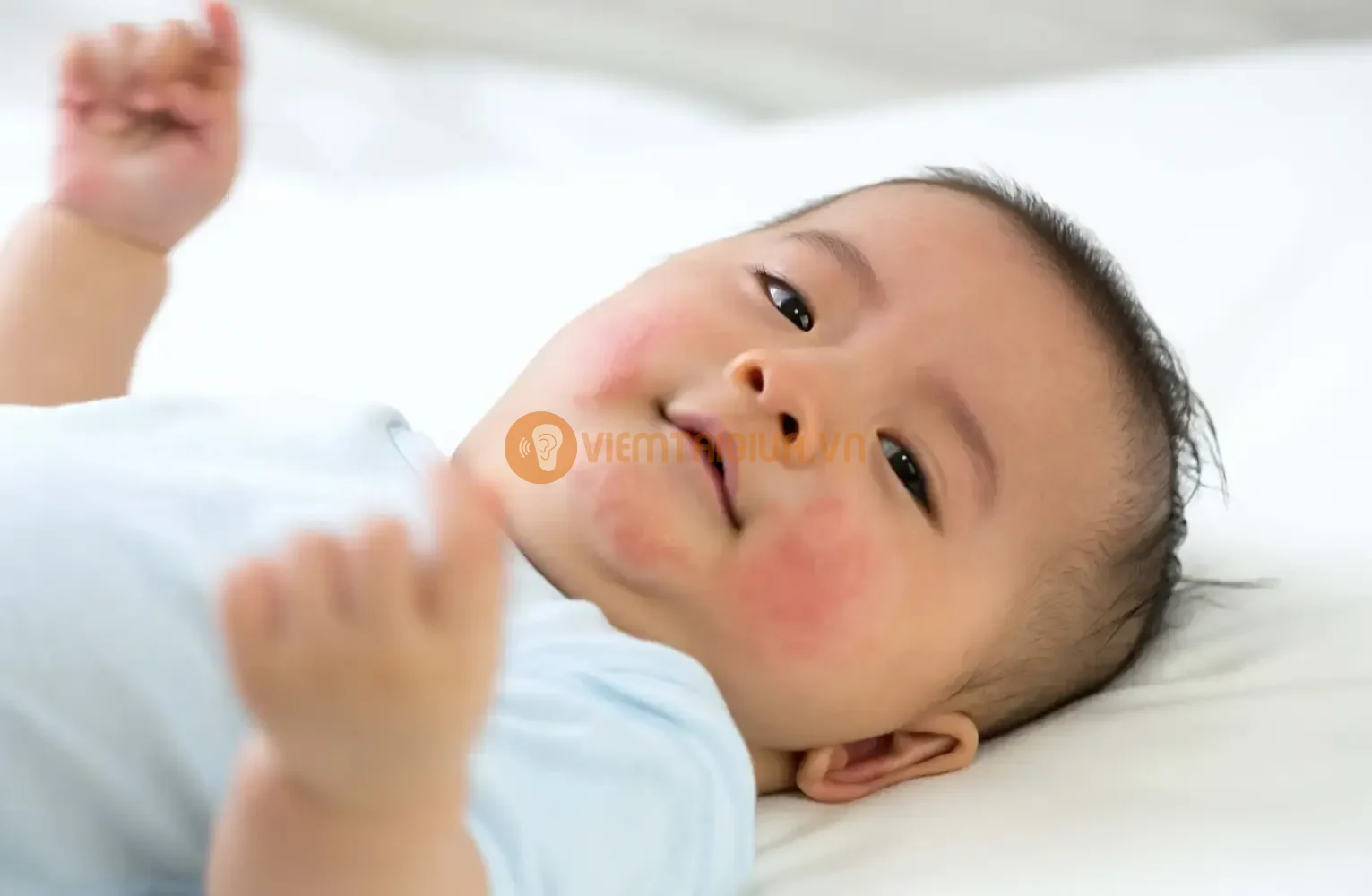Trẻ bị dị ứng