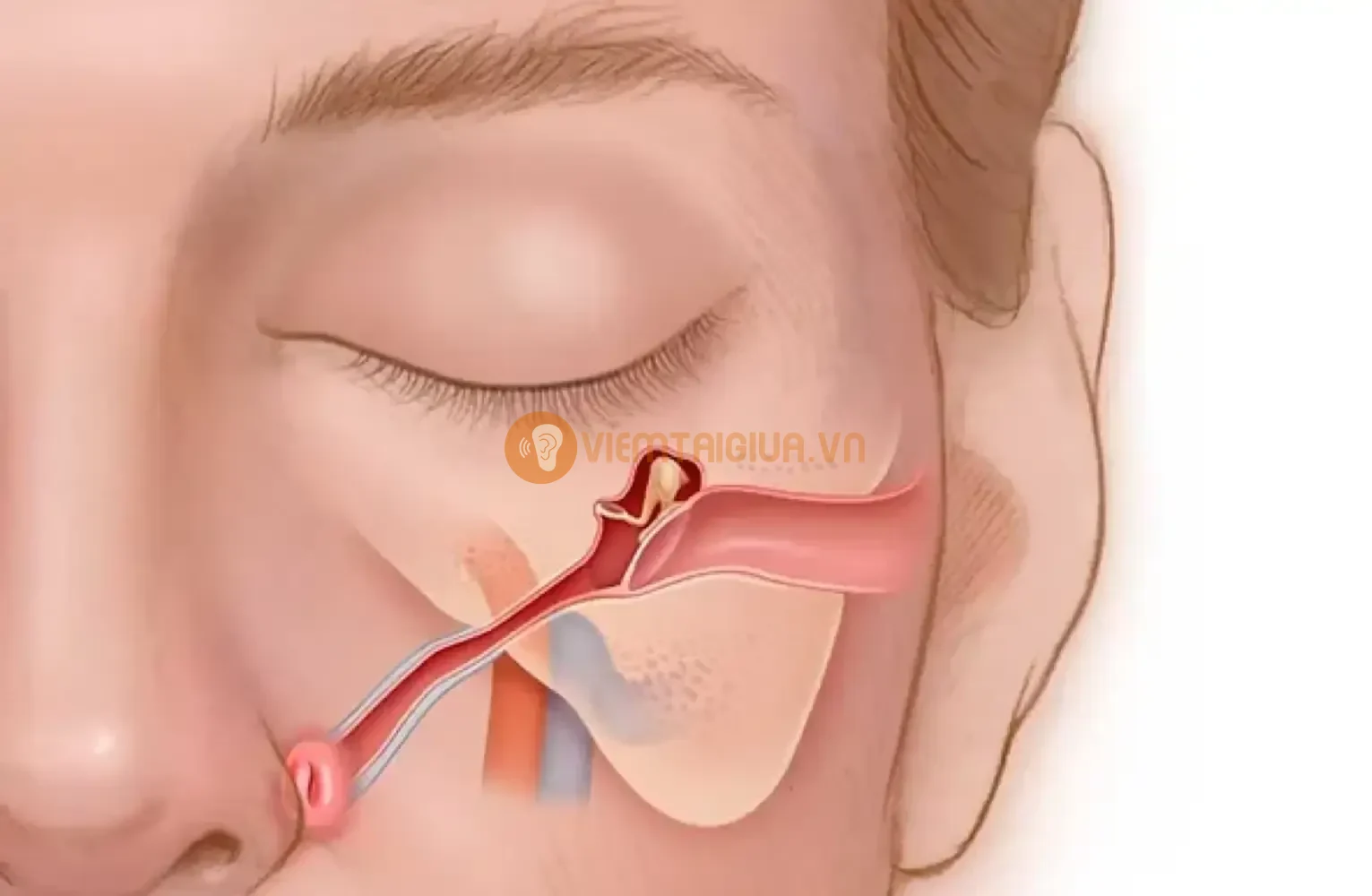 Rối loạn chức năng ống Eustachian