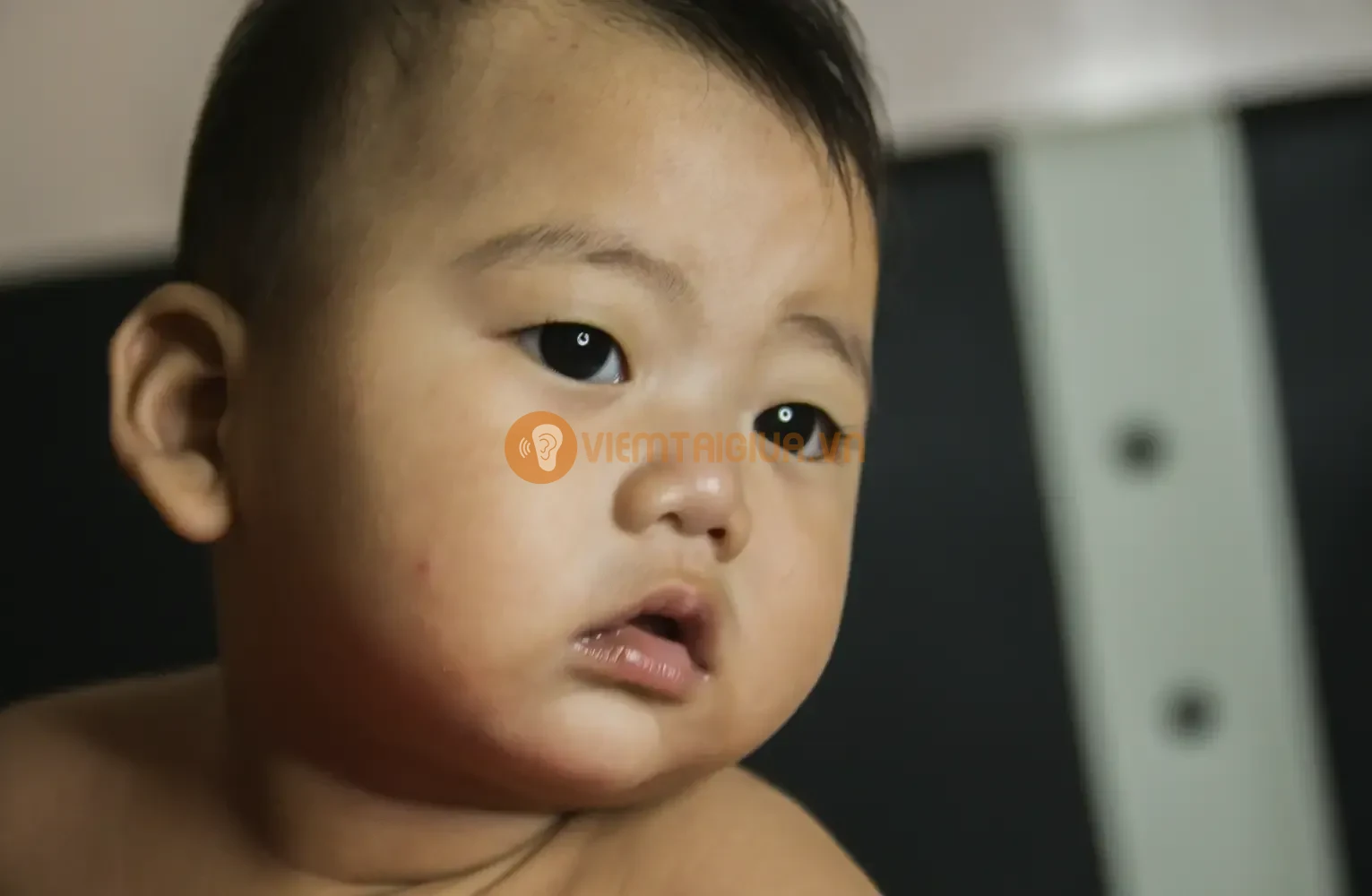 Hãy tham khảo ý kiến bác sỹ và thăm khám kịp thời khi bạn bị thủng màng nhĩ