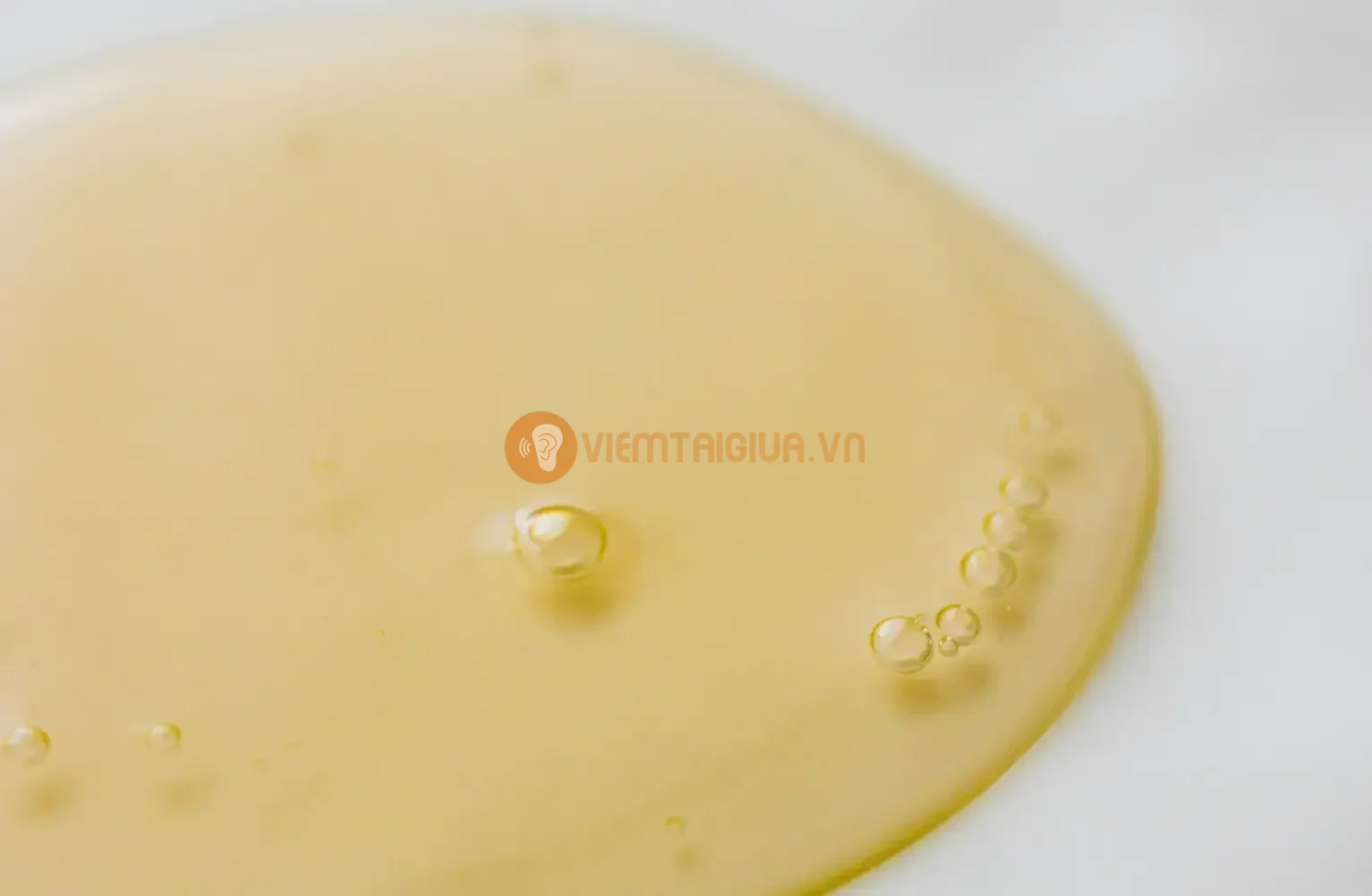 Giữ vệ sinh tai và tránh các bệnh liên quan tới đường hô hấp sẽ giảm nguy cơ viêm tai giữa