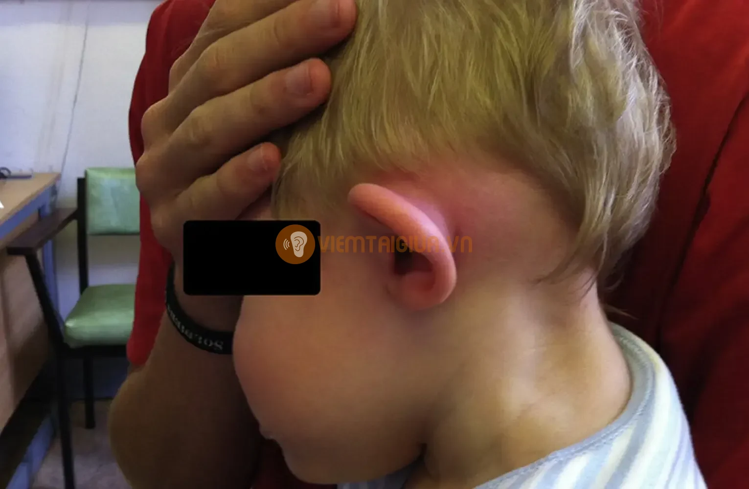 Cần kết hợp nhiều biện pháp khác nhau để chẩn đoán chính xác viêm xương chũm