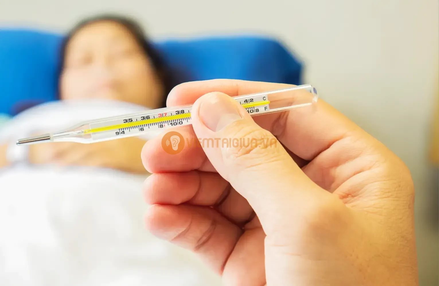 Giai đoạn bùng phát bạn thường sốt cao do viêm
