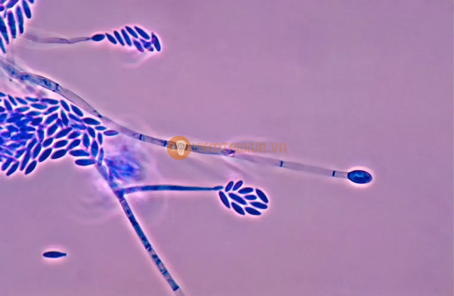 Hình ảnh nấm Fusarium