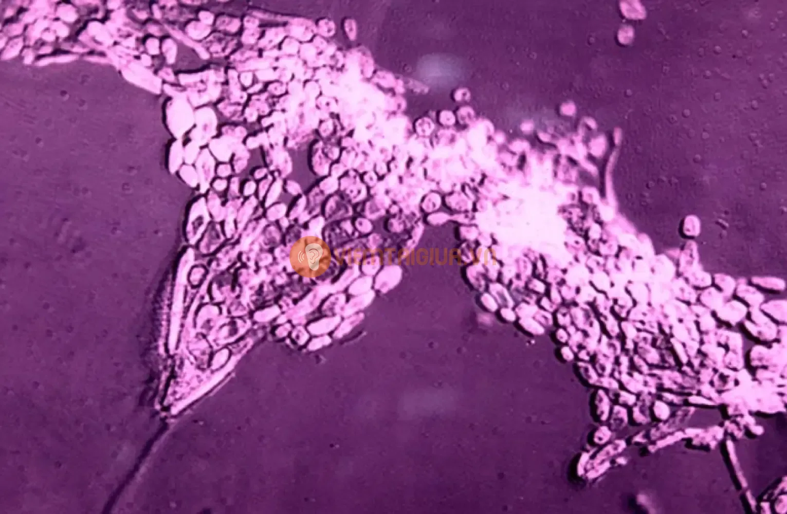 Hình ảnh nấm Candida