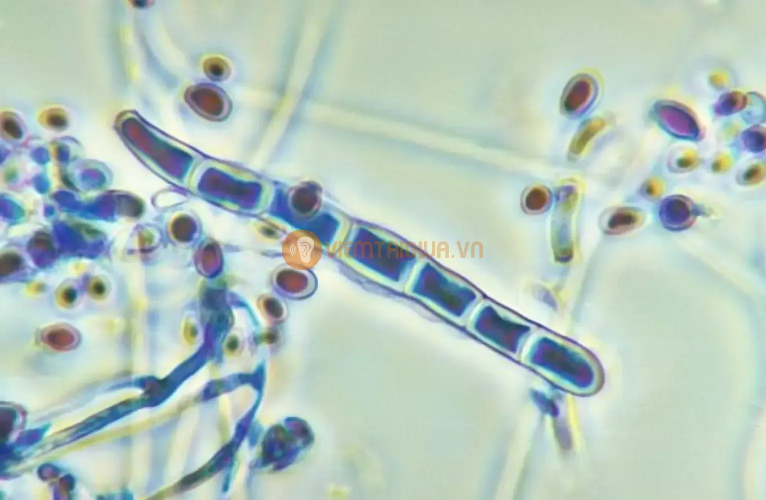 Hình ảnh nấm Trichophyton