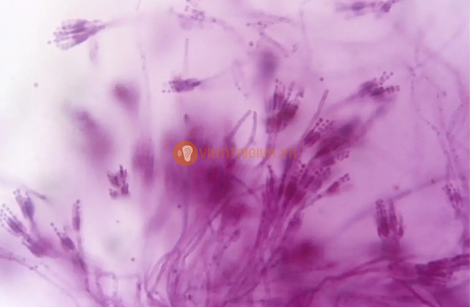 Hình ảnh nấm Penicillium