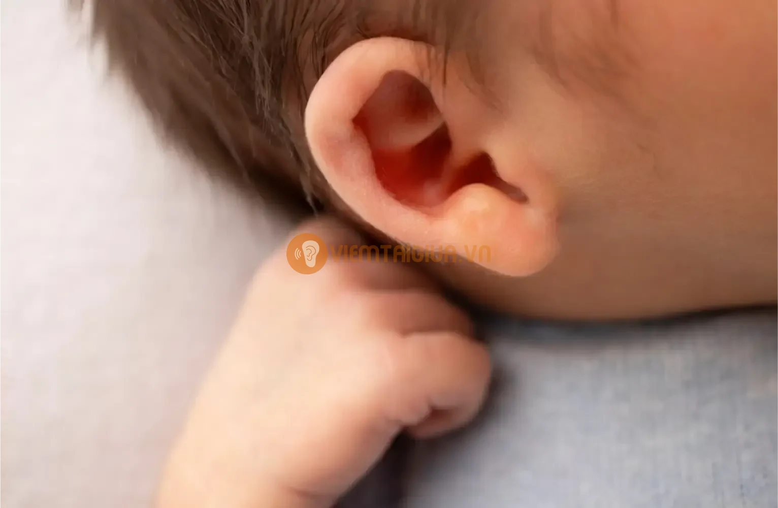Lượng dịch mủ giảm đi là dấu hiệu cho thấy sự viêm nhiễm đang giảm dần