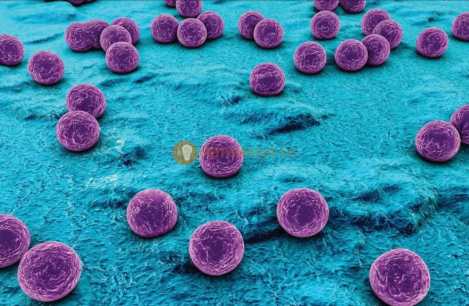 Hình ảnh vi khuẩn Staphylococcus aureus