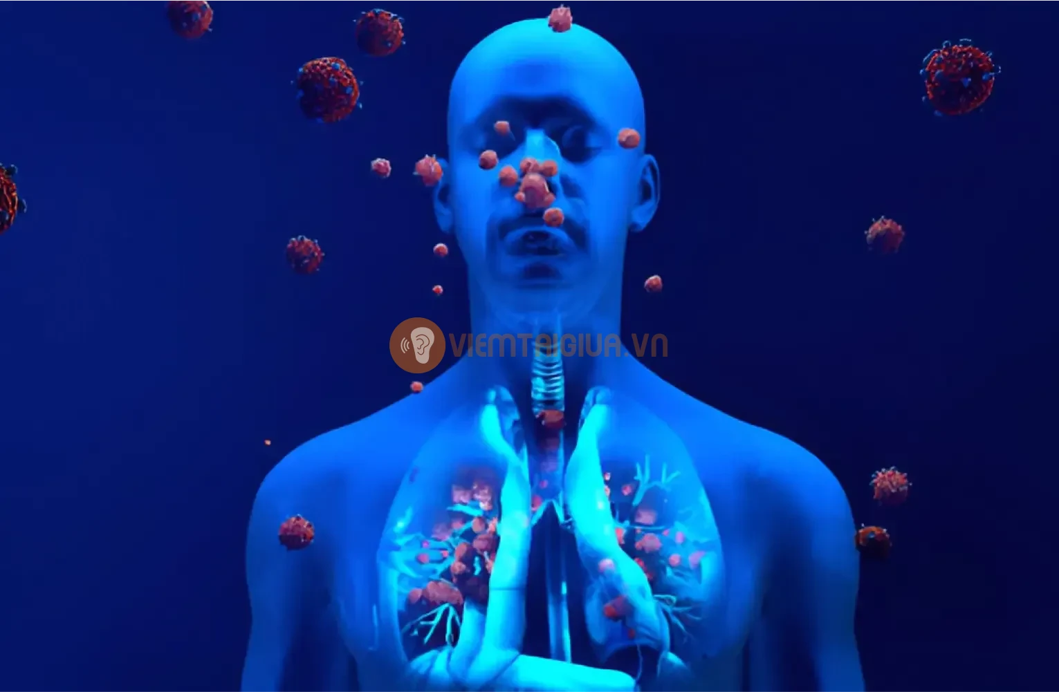 Ngoài nhiễm trùng do vi khuẩn, virus và tắc nghen ống Eustachian thì yếu tố môi trường và di truyền cũng là nguyên nhân gây viêm tai giữa phổ biến