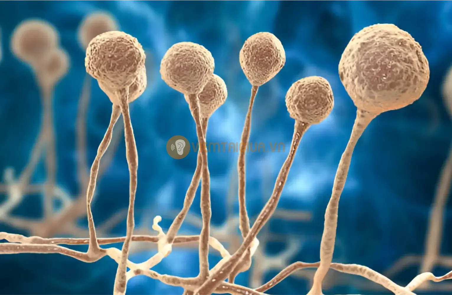 Phát hiện nguyên nhân viêm tai giữa giúp điều trị kịp thời và hiệu quả