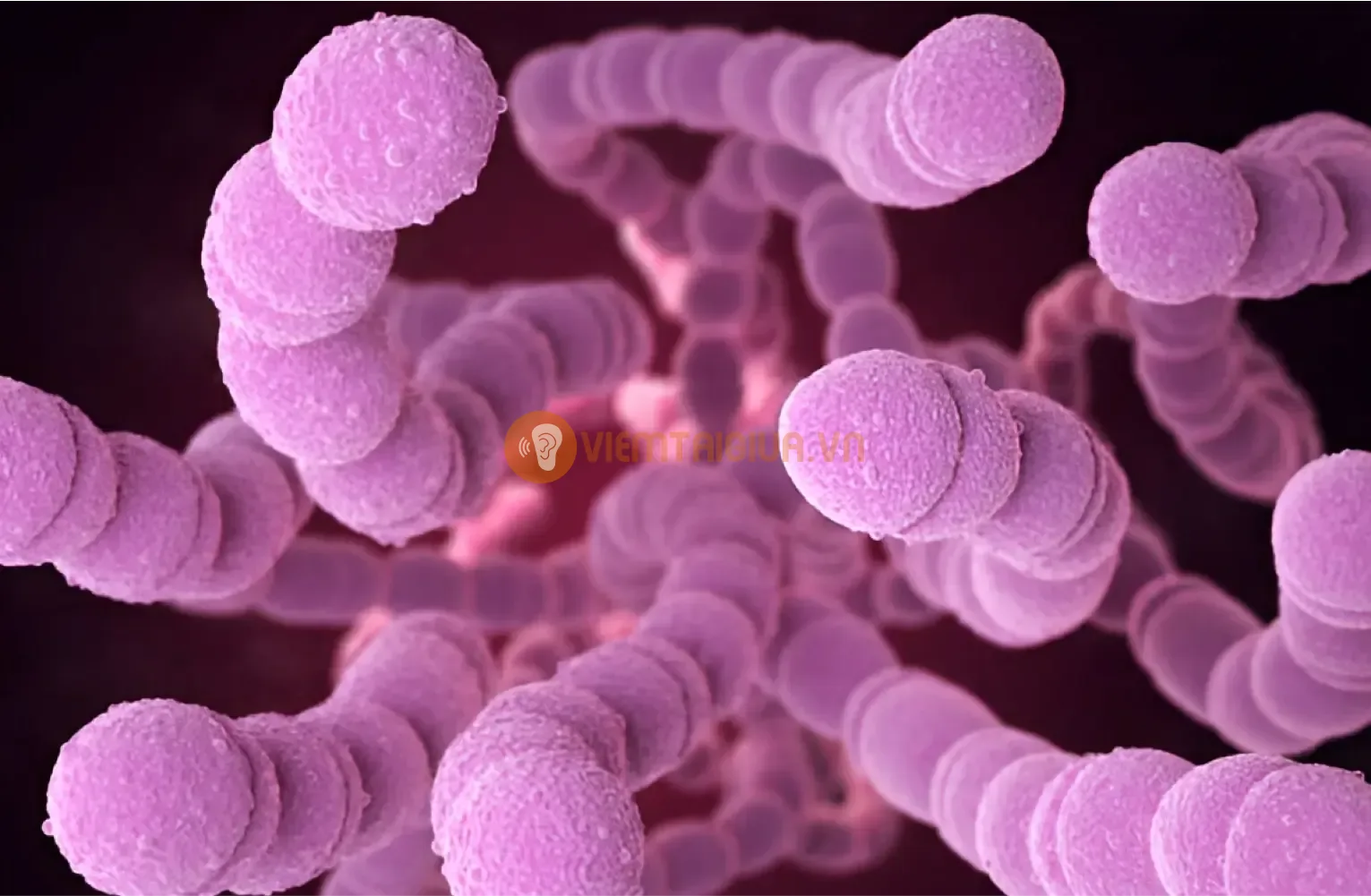 Streptococcus pneumoniae là tác nhân phổ biến gây viêm tai giữa cấp tính ở trẻ