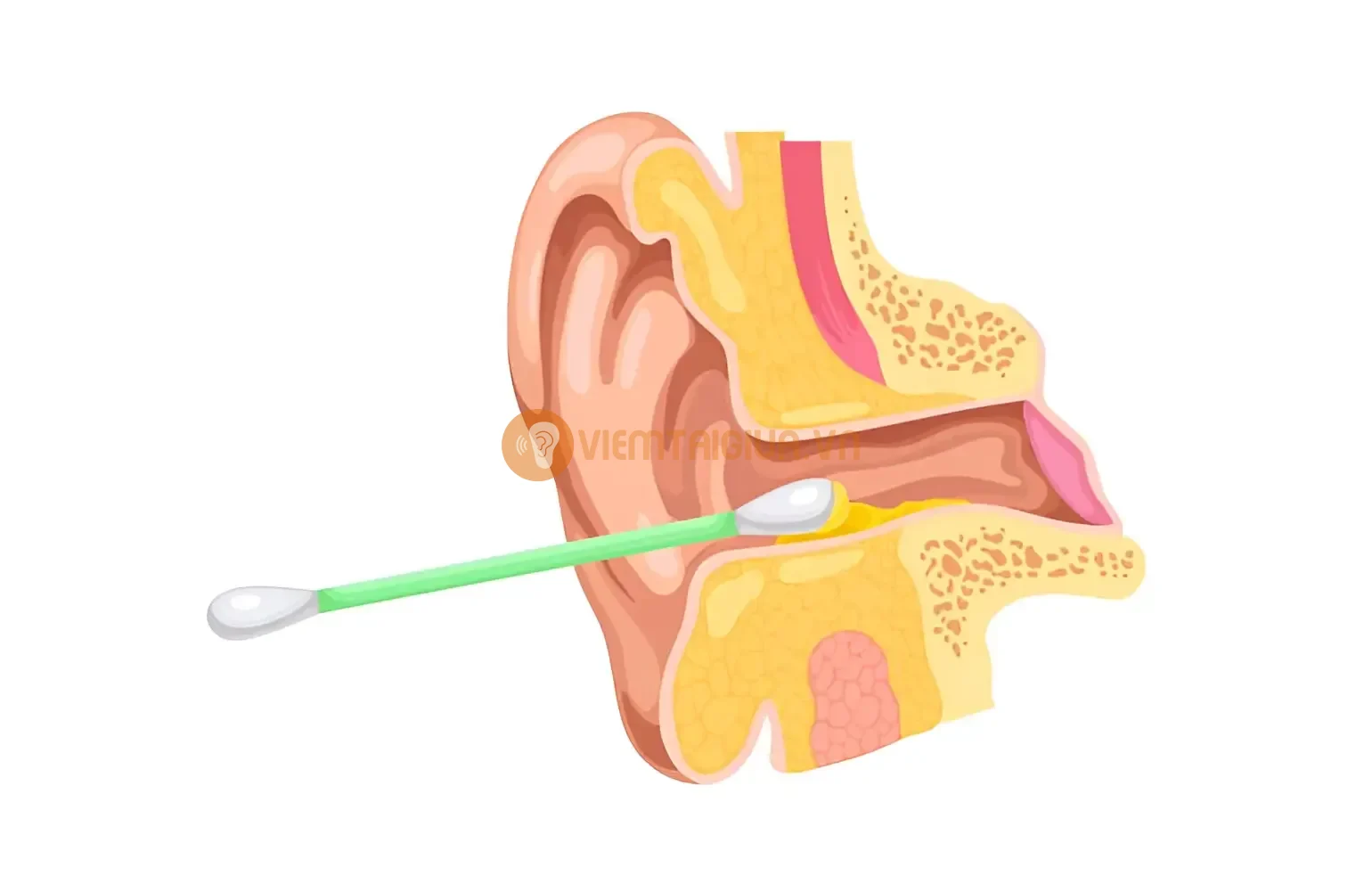Tuyến sản xuất ráy tai liên tục sản xuất chất tiết bao bọc lấy bụi và vi khuẩn