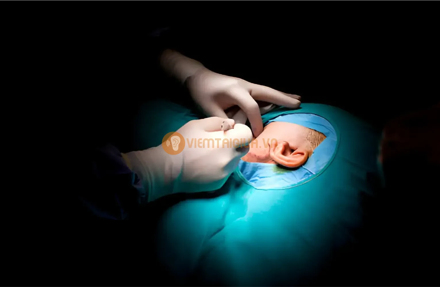 Đối với các ca bệnh nặng và nhiễm trùng tái phát nhiều lần sẽ được bác sĩ chỉ định can thiệp ngoại khoa
